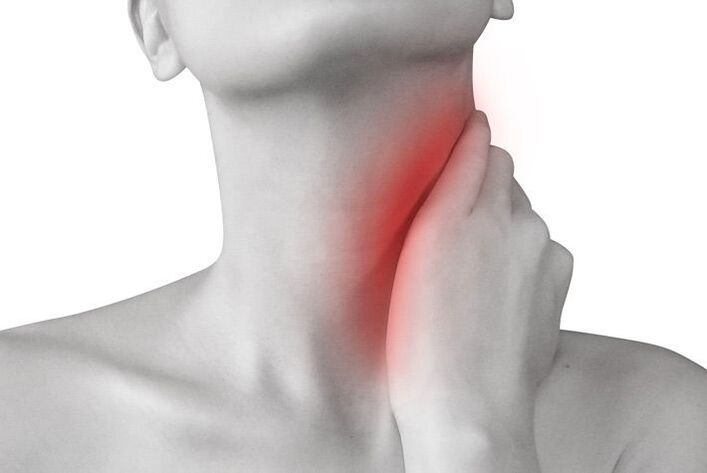 zapalenie węzłów chłonnych jako przyczyna bólu szyi