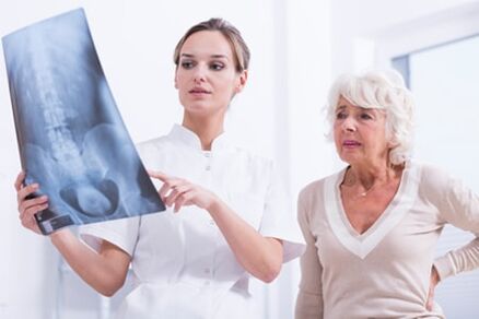 Badanie rentgenowskie jest informacyjnym sposobem diagnozowania osteochondrozy kręgosłupa
