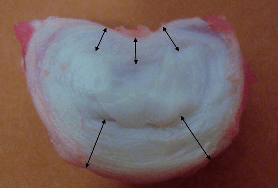 jak wygląda krążek międzykręgowy