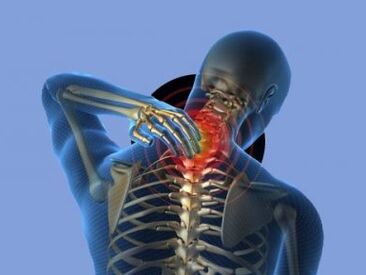 Osobę z osteochondrozą odcinka szyjnego kręgosłupa dokucza ból szyi