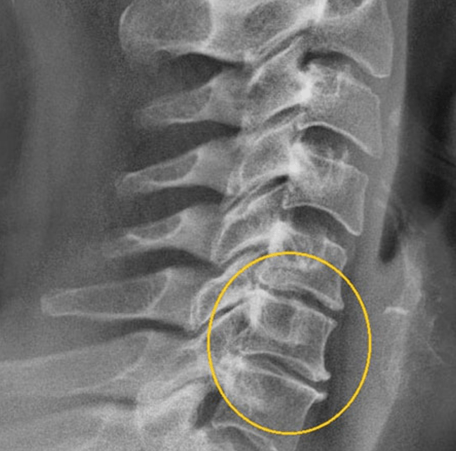 Zdjęcie diagnostyczne